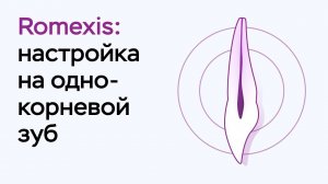 Возможности программы Romexis Viewer: настройка на однокорневой зуб