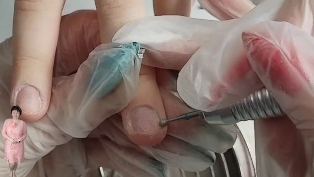 Наращивание на гелевые типсы ПРЕОБРАЖЕНИЕ #nails#nailart##сложныеногти