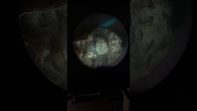 дробление камня лазером #tashkent #urology #uzbekistan смотреть онлайн