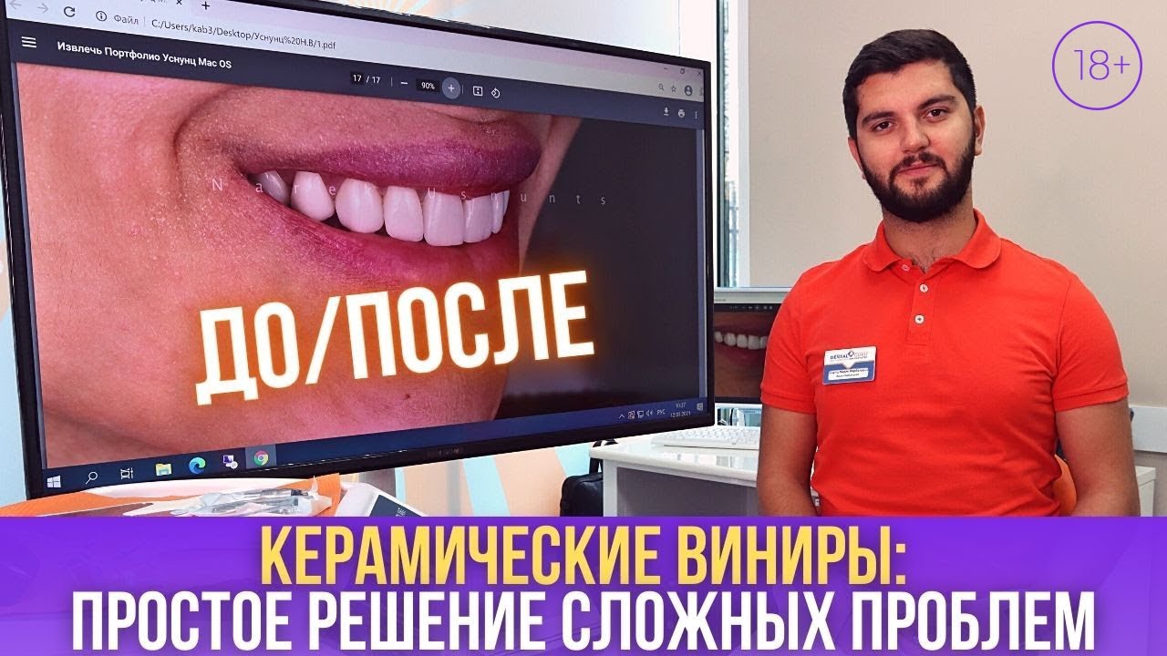 Простое решение сложных проблем!