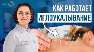 Иглотерапия - как это работает?