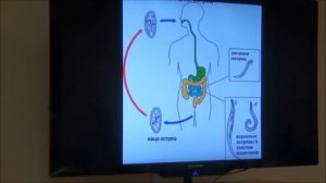 2Паразиты Энтеробиоз острицы