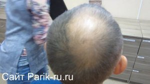 Загуститель волос Toppik. Как использовать. Видео с покупателем.