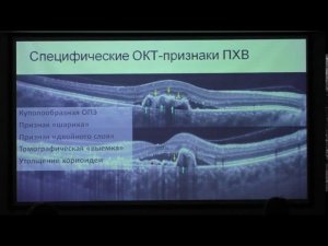 ОКТ-ангиографическая панорама хориоидальной неоваскуляризации Докладчик Панова И.Е.