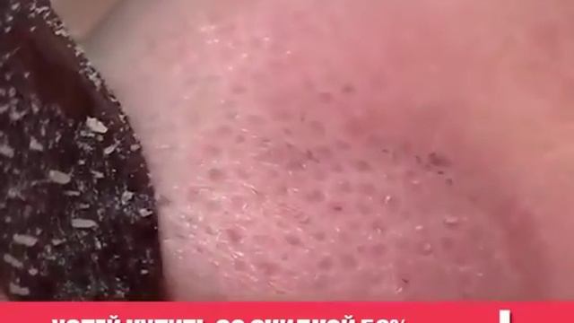 маска черных точек смотреть онлайн