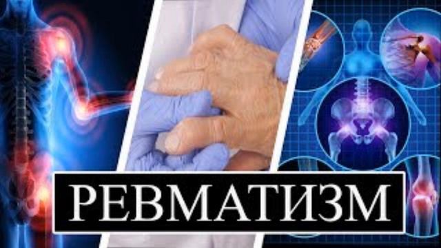 Лечение с гарантией в домашних условиях, ревматизма и полиартрита смотреть онлайн