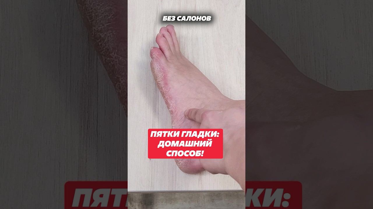 Как сделать пятки гладкими, домашний способ! #пятки #пяткигладки #лайфхак #уходовыесредства #советы