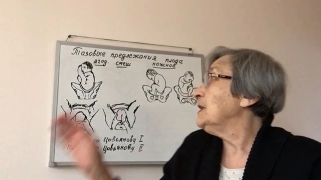 Тазовое предлежание: пособия по Цовьянову I, II (71) смотреть онлайн