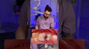 ? Удалять или спасать молочные зубы? Клинический случай детской стоматологии "Дентал Фэнтези"