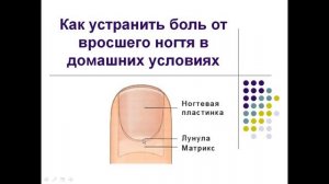 Вросший ноготь. Как устранить боль от вросшего ногтя дома