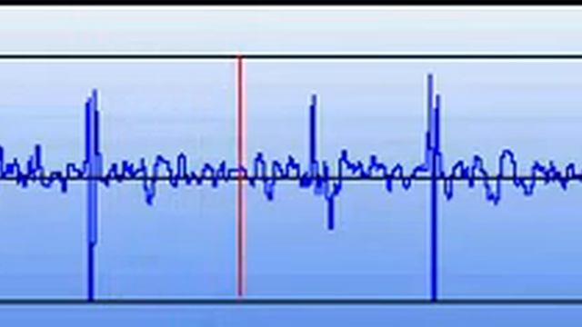 ГКМП смотреть онлайн
