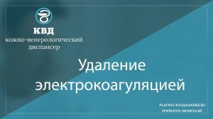 876  Удаление электрокоагуляцией