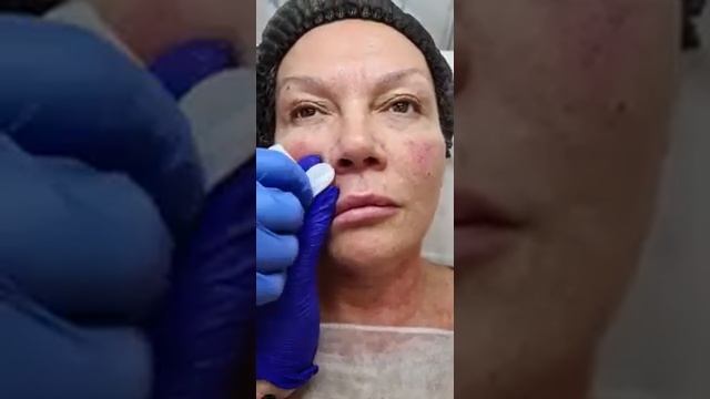 Протокол DROP FEEL ADVANCE терапия смотреть онлайн