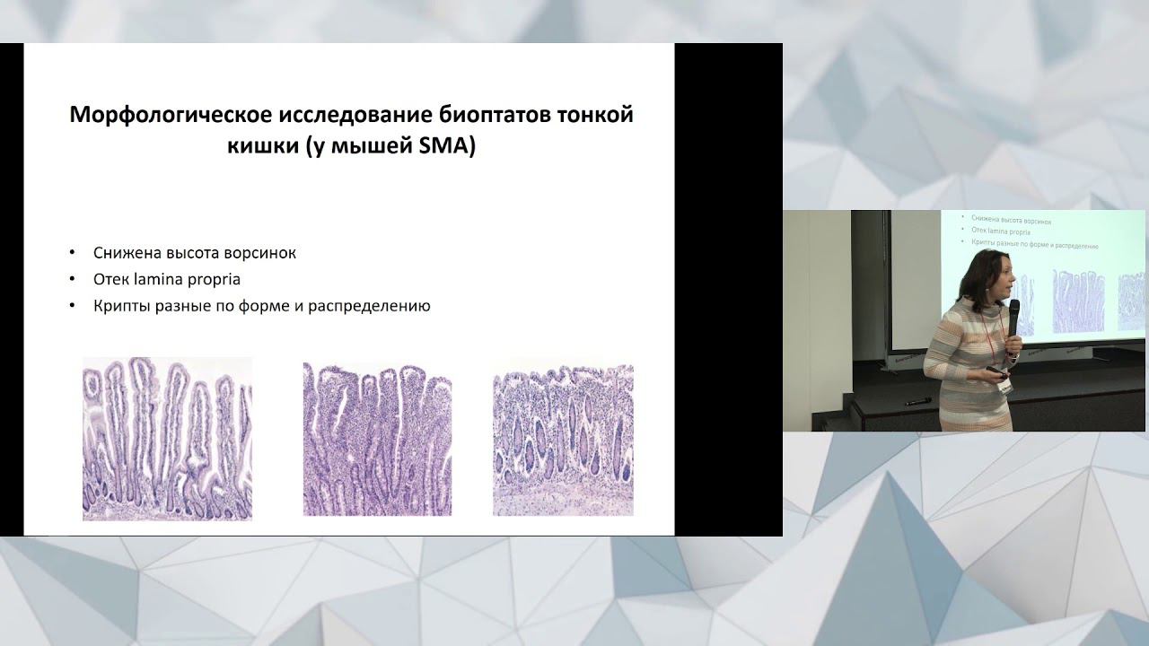 Особенности желудочно-кишечного тракта у пациентов со СМА. Основные нарушения и их коррекция