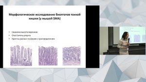 Особенности желудочно-кишечного тракта у пациентов со СМА. Основные нарушения и их коррекция