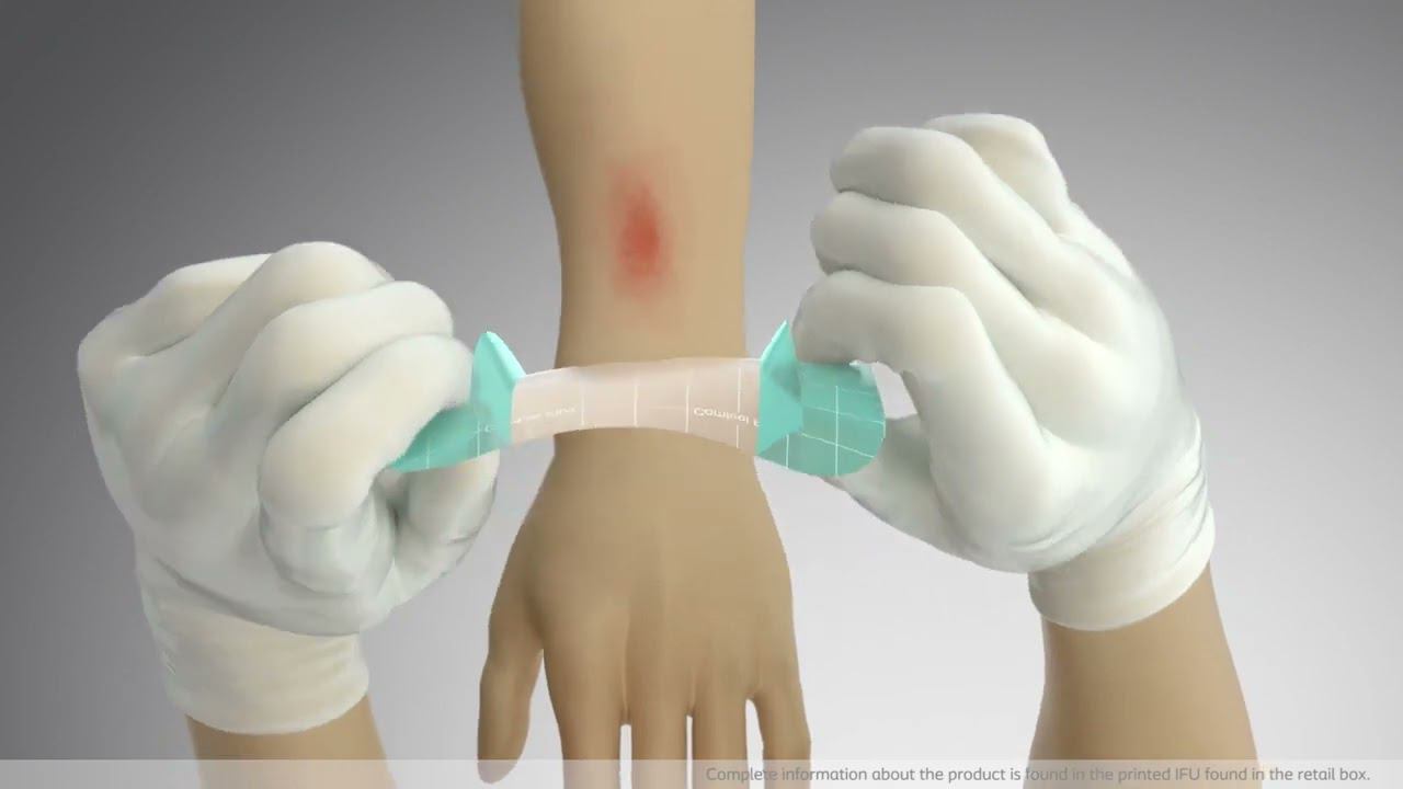 Прозрачные повязки Комфил плюс инструкция смотреть онлайн