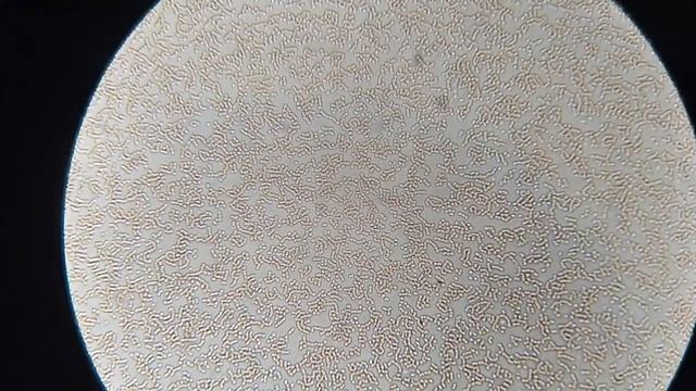 Кровь после шиповника смотреть онлайн