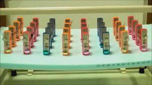 32 метронома синхронизируются