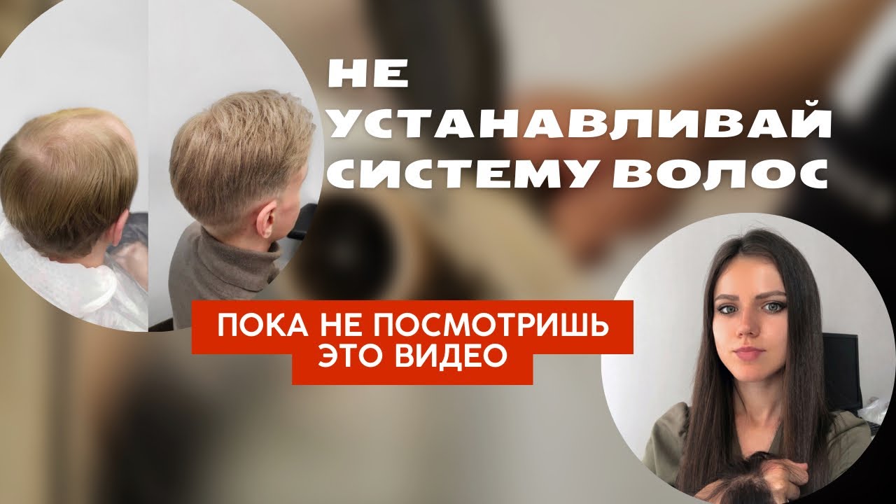 Система волос для мужчины - как решиться? Что делать, если лысеешь? Могу помочь)