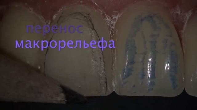 Шлифовка и полировка реставрации. ??
