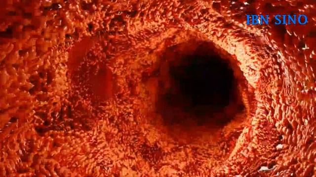БУЙРАК ВА СИЙДИК ЙЎЛИ ШАМОЛЛАШИНИ УЙ ШАРОИТИДА ДАВОЛАЙМИЗ. ХАЛҚ ТАБОБАТИ