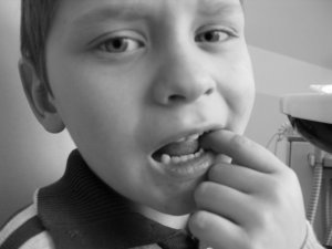 Детская стоматология. Удаление молочного зуба - это не больно.mp4