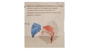 Как сделать экспресс тест на ковид19 в домашних условиях.