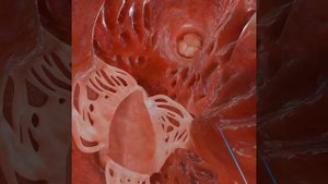 Правый желудочек (внутри сердца)