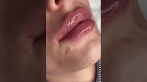 Мудские губы