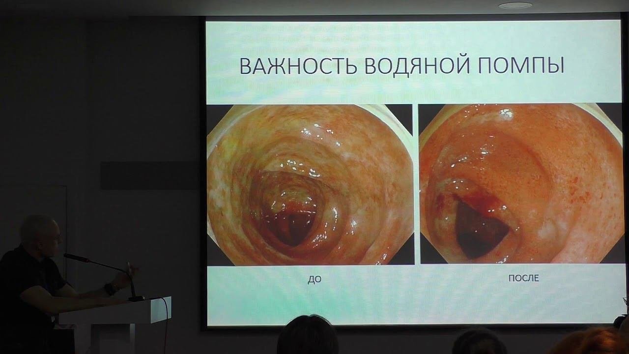03 Корнеев АА Экспертная эндоскопическая диагностика ВЗК