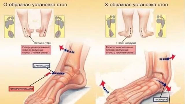 ЗаДЕЛО: ТРЕНД. Высокие каблуки смотреть онлайн