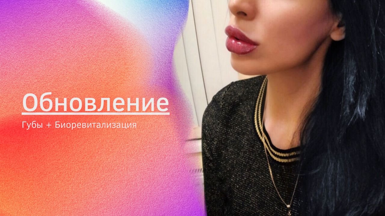 Коррекция формы губ и биоревитализация