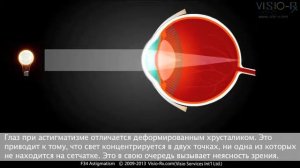 Что такое астигматизм: простая коррекция при помощи цилиндра в очках.