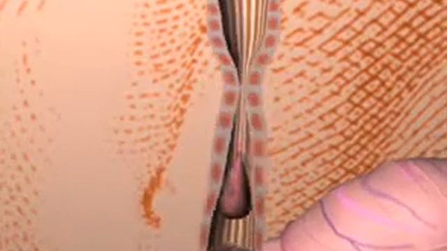 Перистальтика пищевода смотреть онлайн