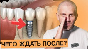 КАК ЗУБНЫЕ ИМПЛАНТЫ ИЗМЕНЯТ ВАШУ ЖИЗНЬ?