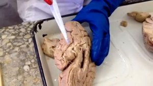 Конечный мозг