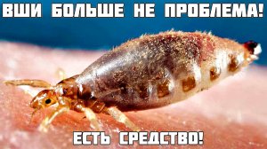 Это средство избавит от вшей за 1 применение! Как избавиться от вшей как бороться с вшами?