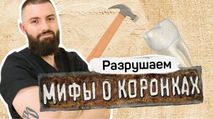 6 мифов о зубных коронках. Что правда, а что ложь?