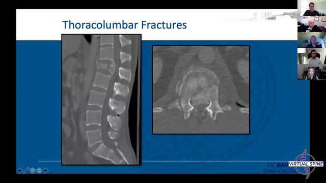 Thoracolumbar Trauma with Dr. Eric Kleinberg смотреть онлайн