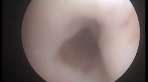 стриктура уретры у собаки