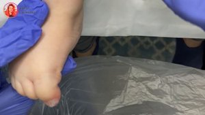 Воспалился пальчик у младенца / Неправильно постригла ногти ребенку / Педикюр / детский педикюр
