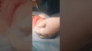 Липофилинг лица и губ в прямом эфире от доктора Жана