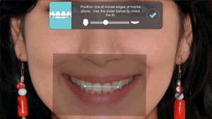 SMILE LI   СТОМАТОЛОГИЯ В ИЗРАИЛЕ 1