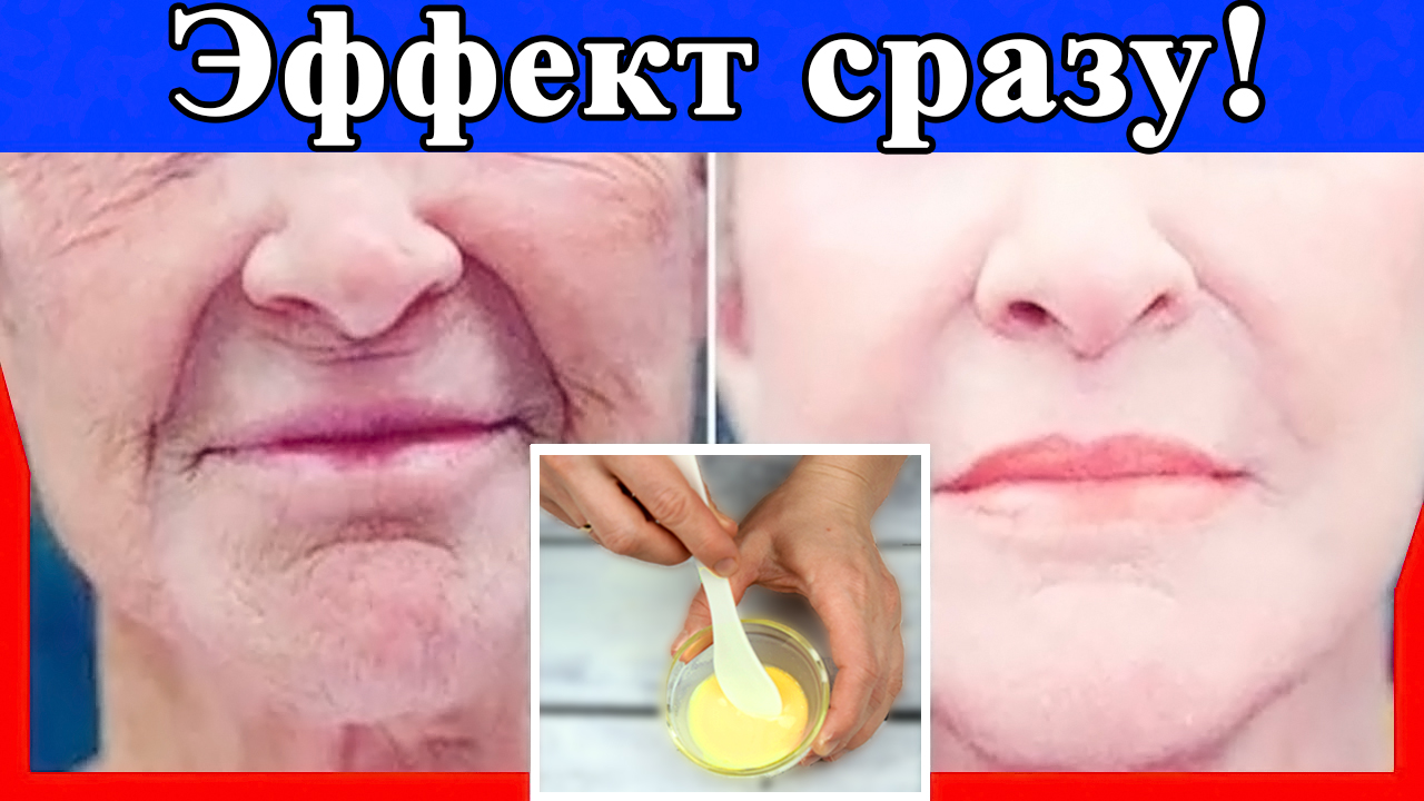 Как убрать морщины? Рецепт омолаживающей маски от морщин c востока
