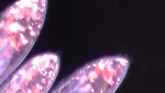 2021 Paramecia swim with nuclei visible смотреть онлайн
