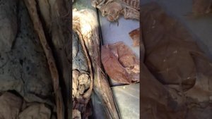 Вены верхней конечностей