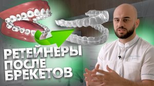 Если стоит ретейнер после лечения на брекетах, возможно поставить виниры?