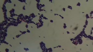 Enterococcus faecalis Colony Morphology and Gram Staining