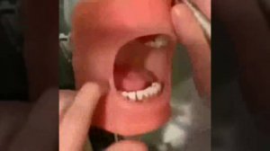На приеме у стоматолога: откройте рот шире, еще...