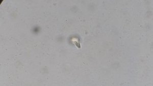 Инфузория Трубач (0063)